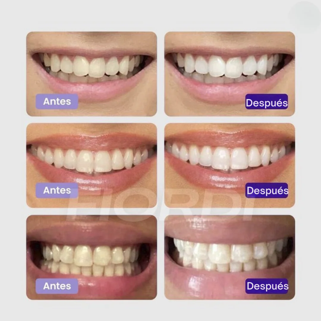 Crema Blanqueadora Hismile - LumiWhite® - Image 3