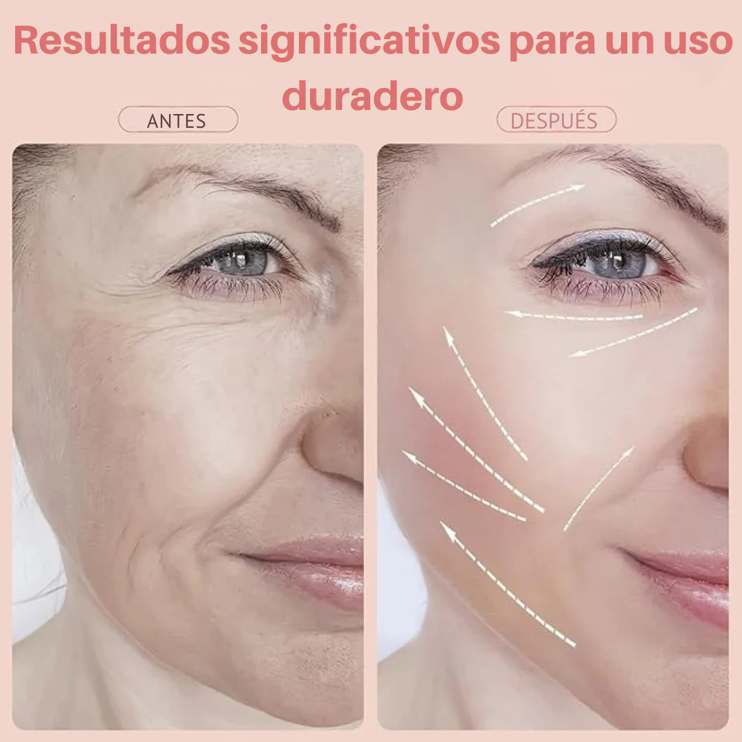 Masajeador Facial Estimulador - LumiSkin® - Image 2